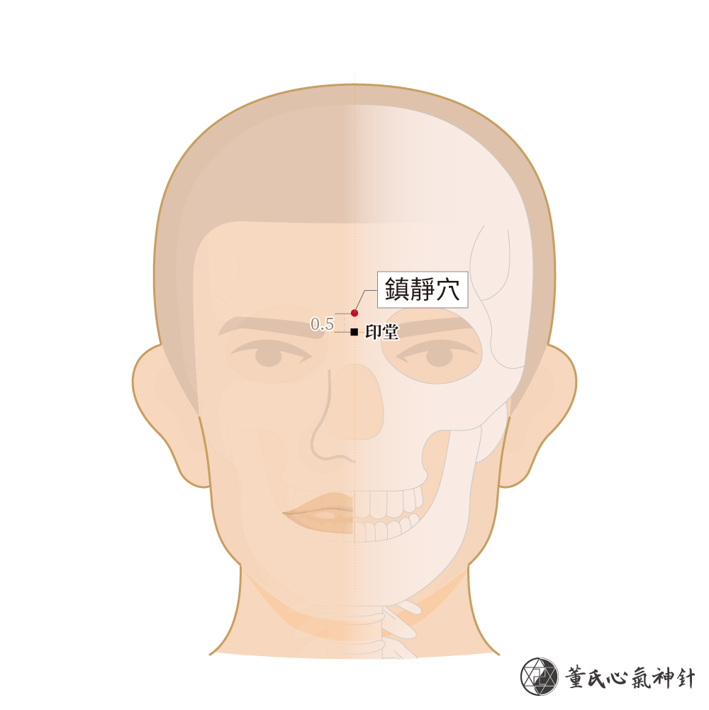鎮靜穴